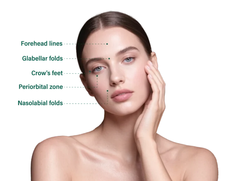 botulinum toxin injection for facial wrinkles