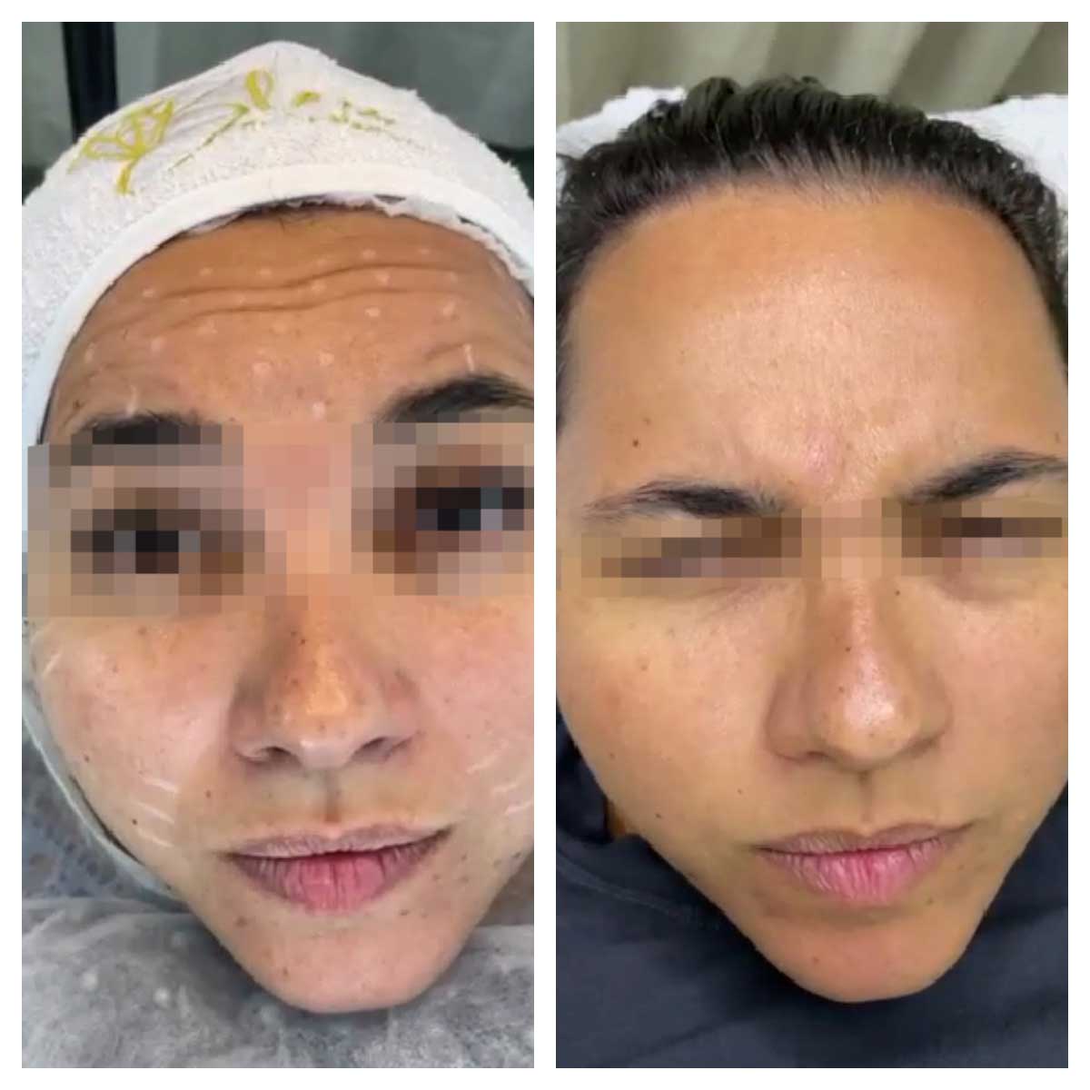 nabota before and after