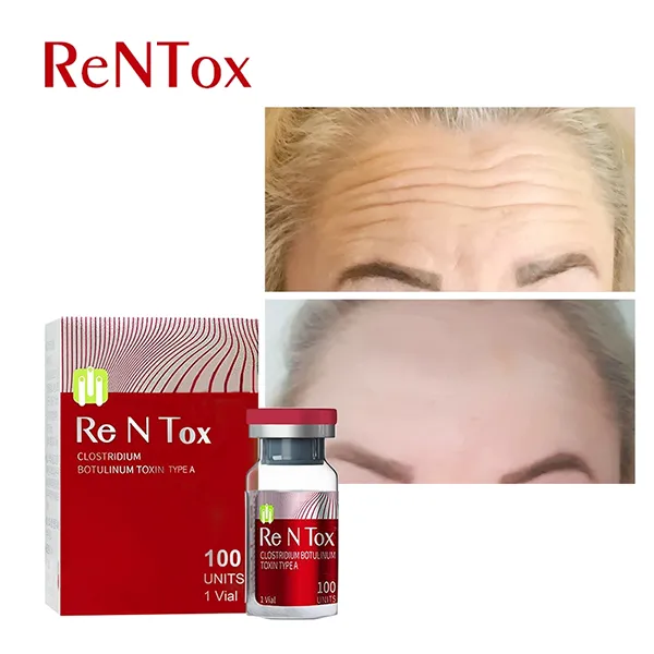 Rentox 100 Units