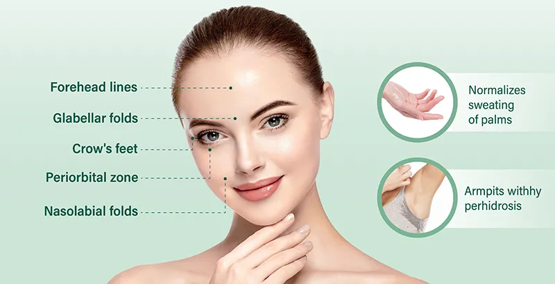 Troxar Injection Toxara 100U Botulinum Toxin Type A Injection - Toxara