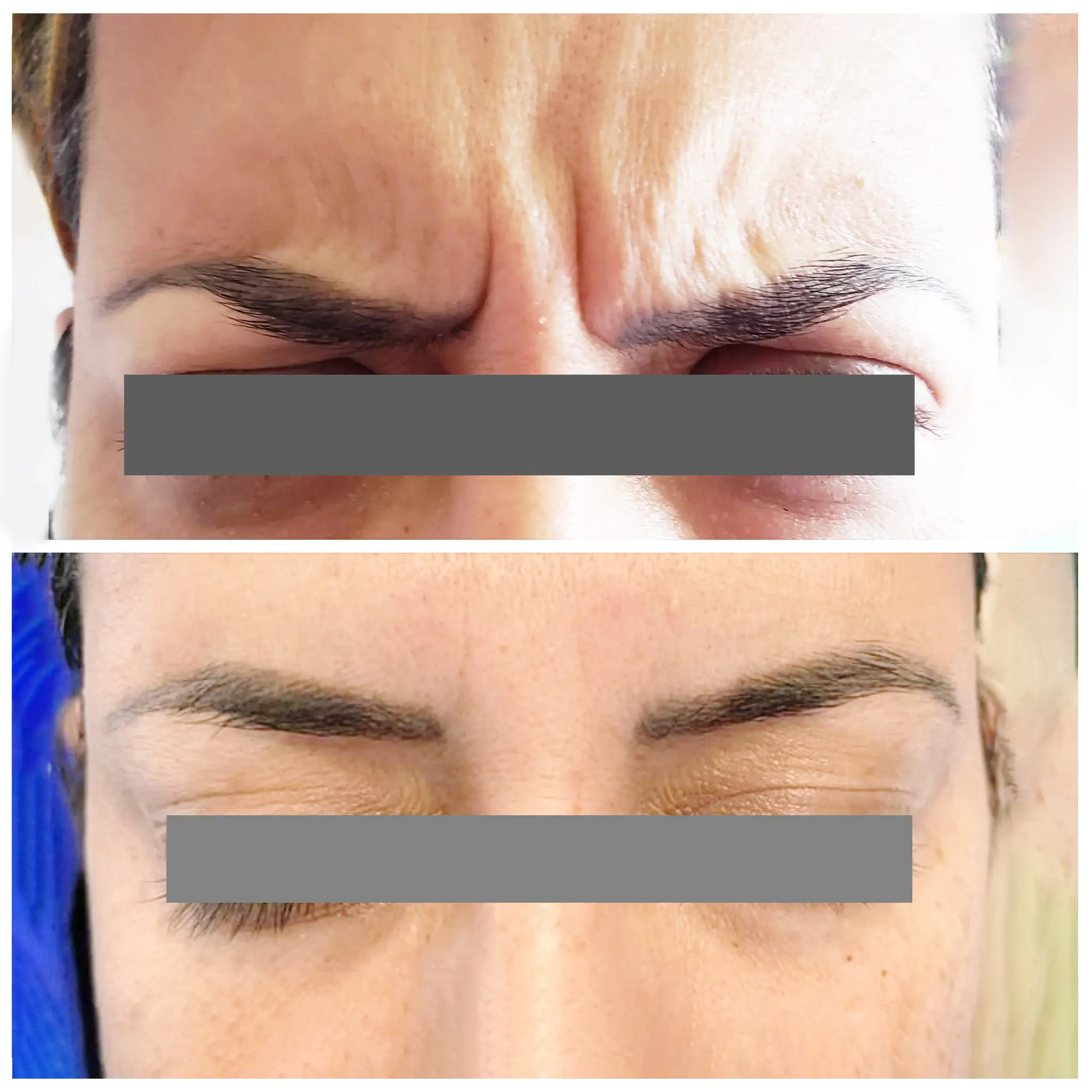 botulinum toxin clinical aesthetic practice