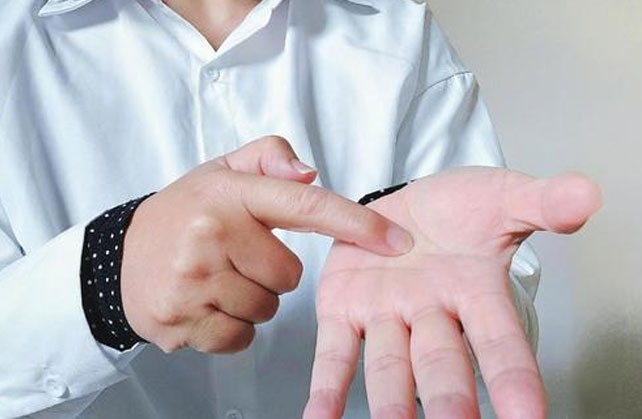 botulinum toxin for palmar hyperhidrosis