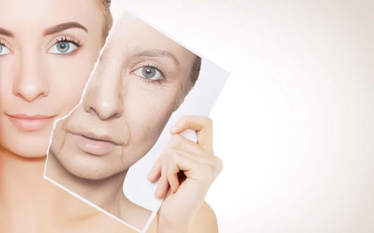 botulinum toxin results timeline