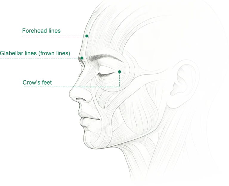 botulinum toxin clinical aesthetic practice