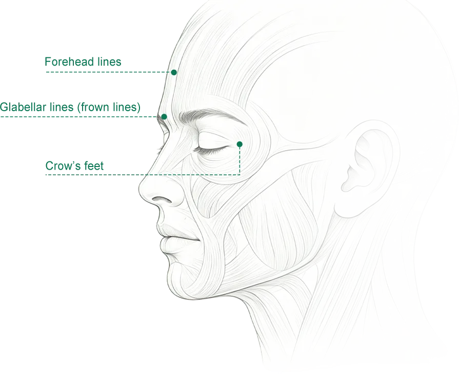 botulinum toxin clinical aesthetic practice