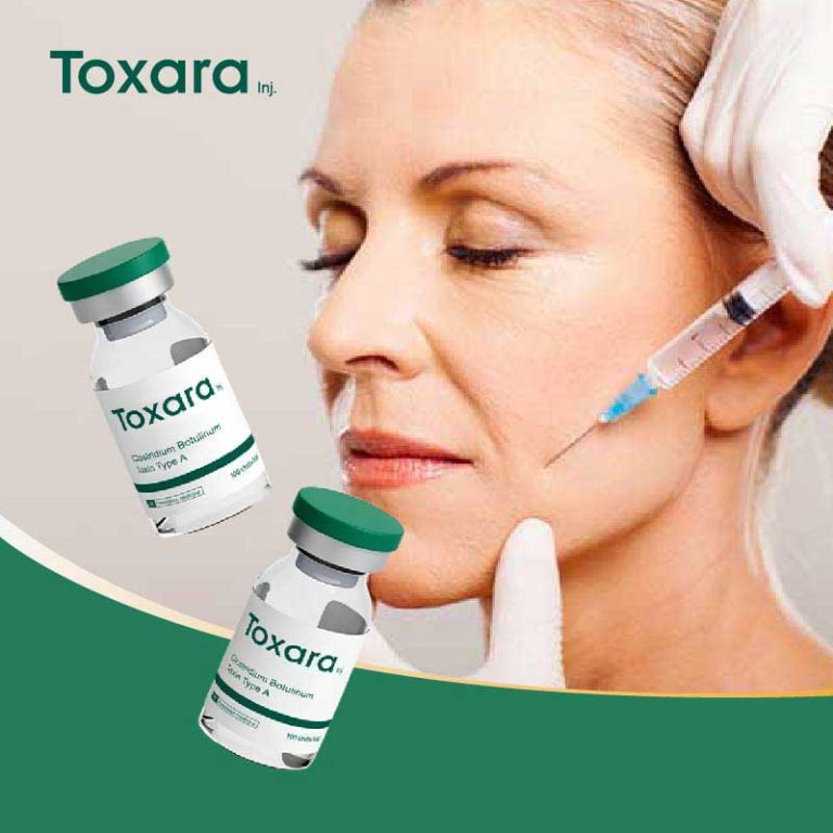 botulinum toxin around the mouth