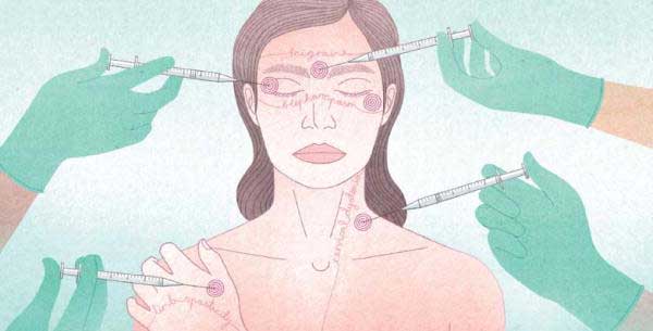 botulinum toxin benefits