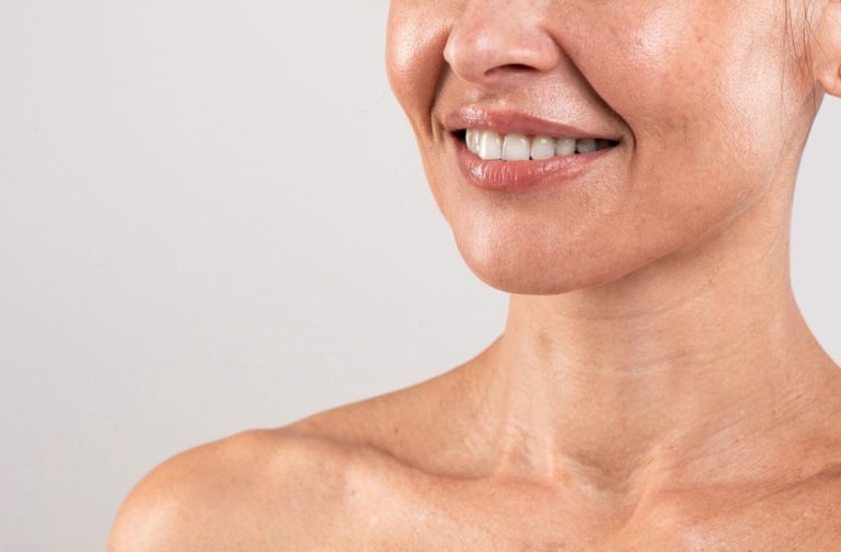 Botulinum Toxin For Laugh Lines